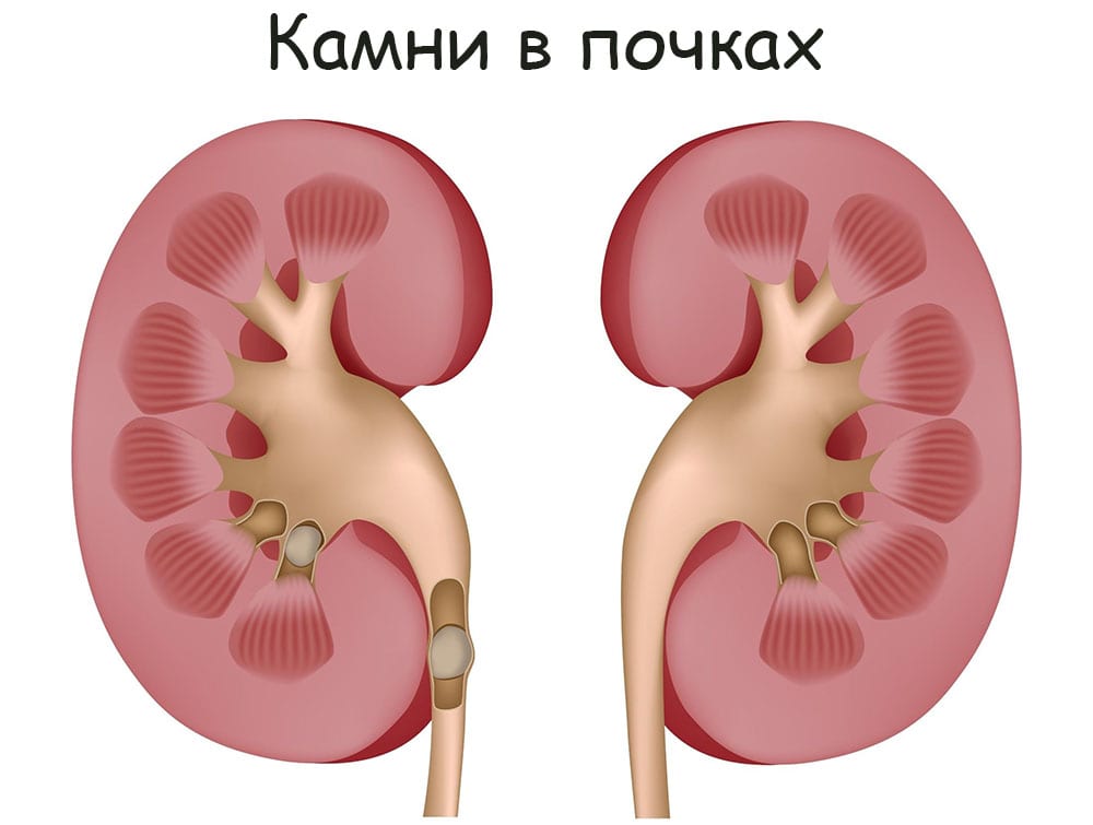 Рабочее зеркало кракен
